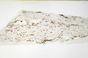 Plane Polarized, S69149