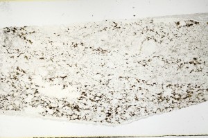 Plane Polarized, S69208