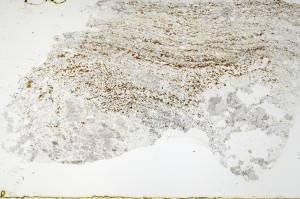 Plane Polarized, S69587