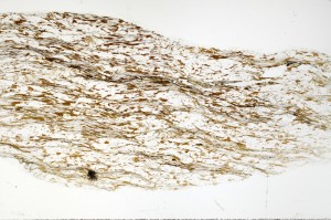 Plane Polarized, S70846