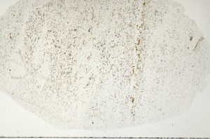 Plane Polarized, S71378