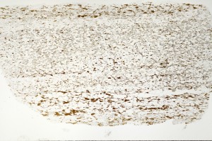 Plane Polarized, S71381