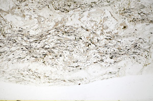 Plane Polarized, S81121