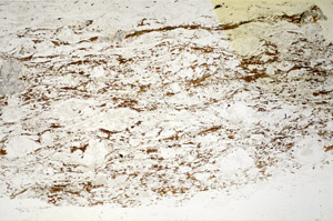 Plane Polarized, S85175