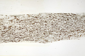 Plane Polarized, S87010