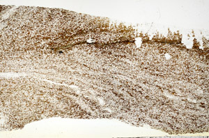 Plane Polarized, S87171