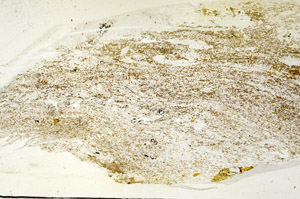 Plane Polarized, S87530