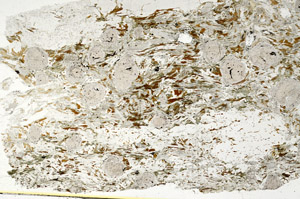 Plane Polarized, S87658