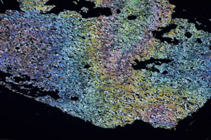 Cross Polarized, S87697