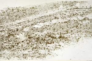 Plane Polarized, S87877