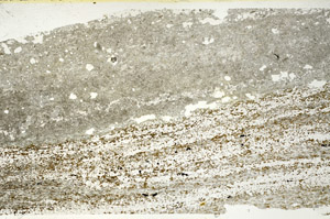 Plane Polarized, S87906
