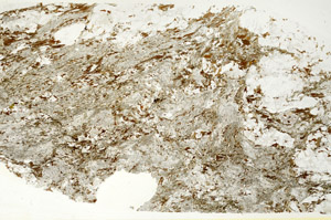 Plane Polarized, S88339