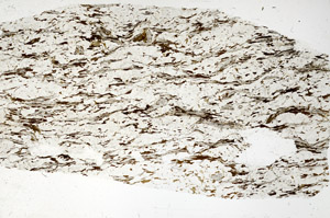 Plane Polarized, S88515
