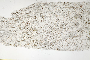 Plane Polarized, S88535