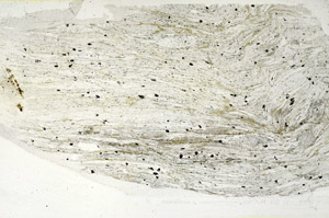 Plane Polarized, S89940