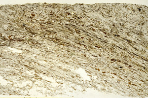 Plane Polarized, S90410