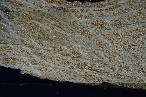 Cross Polarized, N6650
