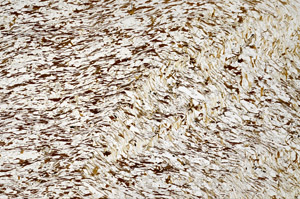 Plane Polarized, N7971