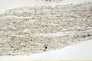 Plane Polarized, N11645