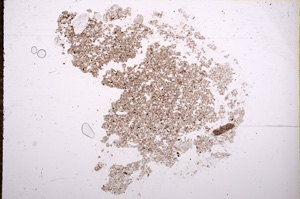 Plane Polarized, E9384