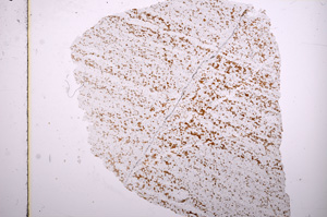 Plane Polarized, E15667
