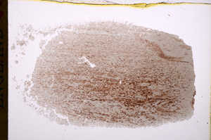 Plane Polarized, E17255