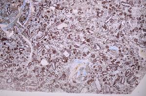 Plane Polarized, E40156