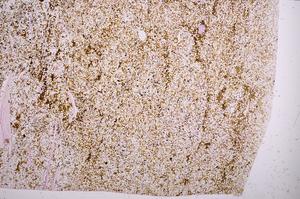 Plane Polarized, E40158