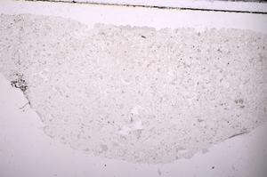 Plane Polarized, E45403