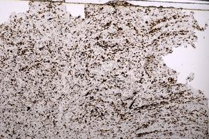 Plane Polarized, E45458