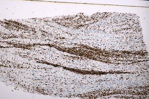 Plane Polarized, E45536