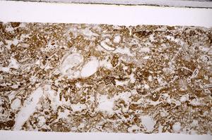 Plane Polarized, E45775A