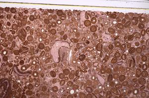 Plane Polarized, E46730