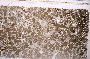 Plane Polarized, E46733