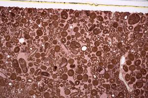 Plane Polarized, E46750