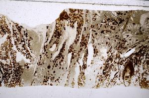 Plane Polarized, E54175