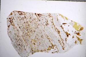 Plane Polarized, E57260