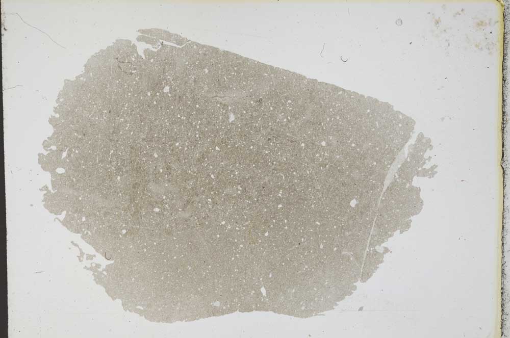 Plane Polarized, S11246