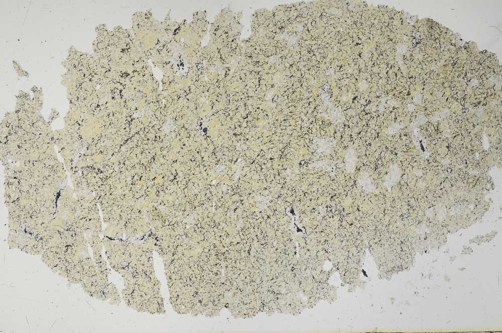 Plane Polarized, S30264
