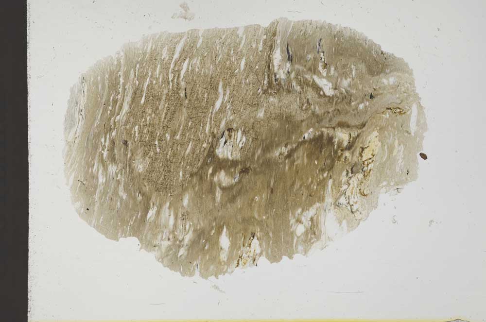 Plane Polarized, S31762