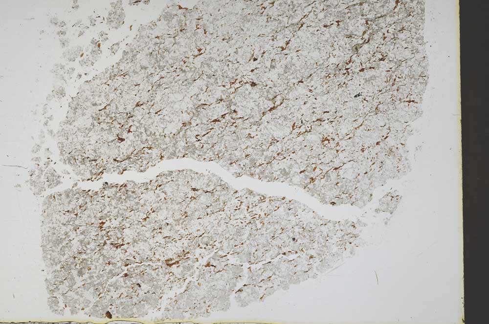 Plane Polarized, S45142