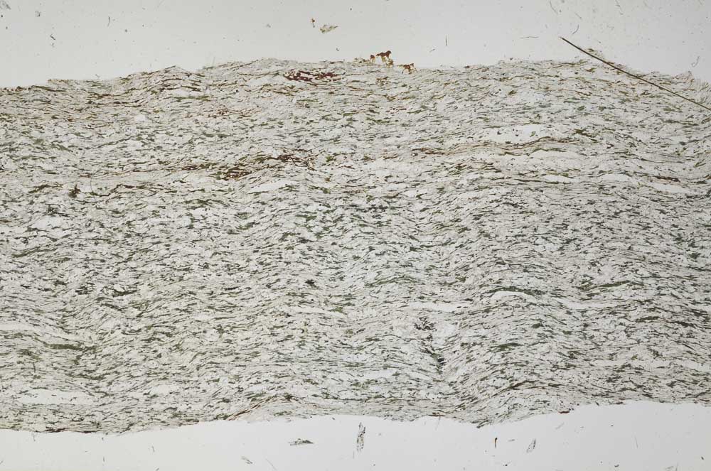 Plane Polarized, S56143