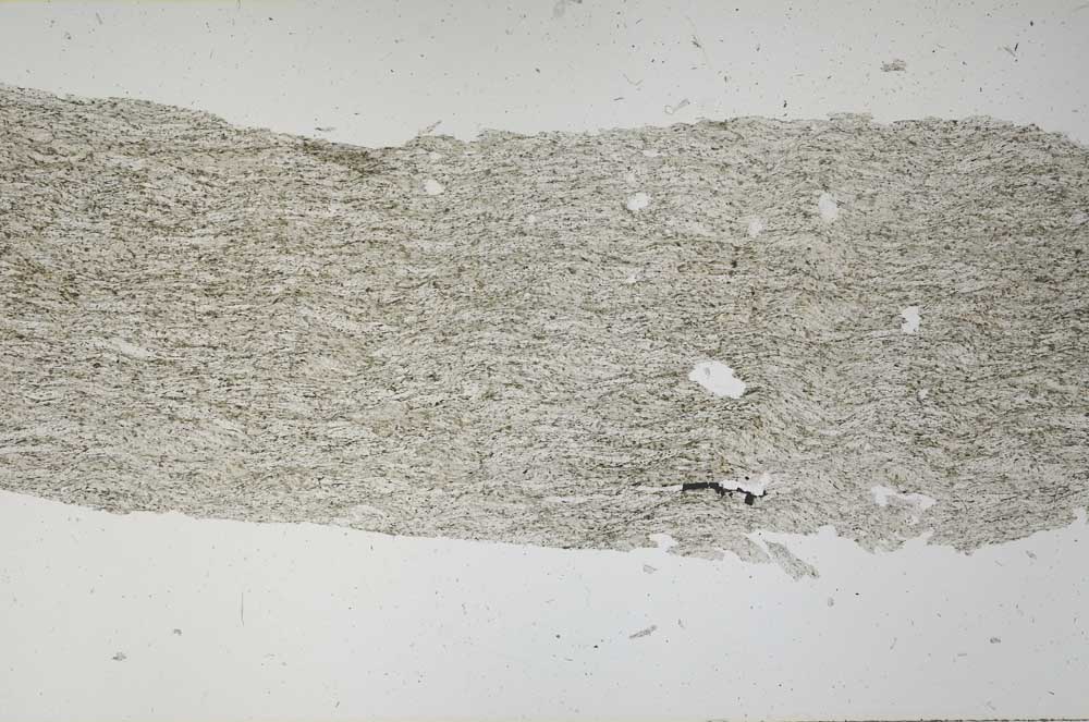 Plane Polarized, S56162