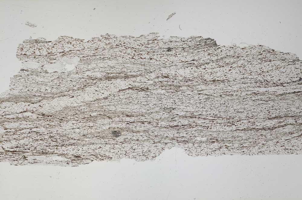Plane Polarized, S56165