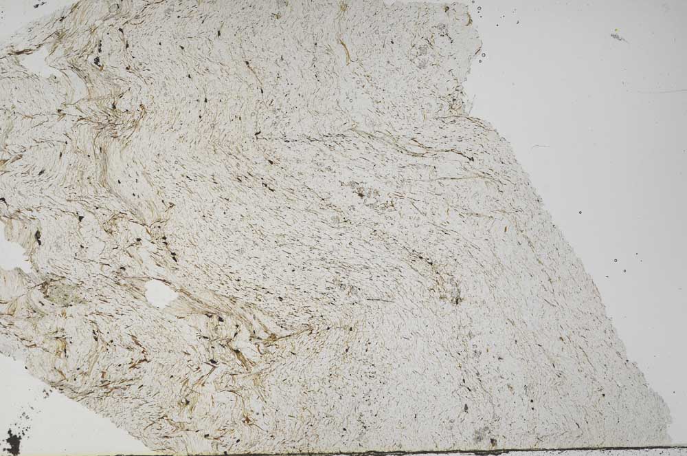 Plane Polarized, S60836