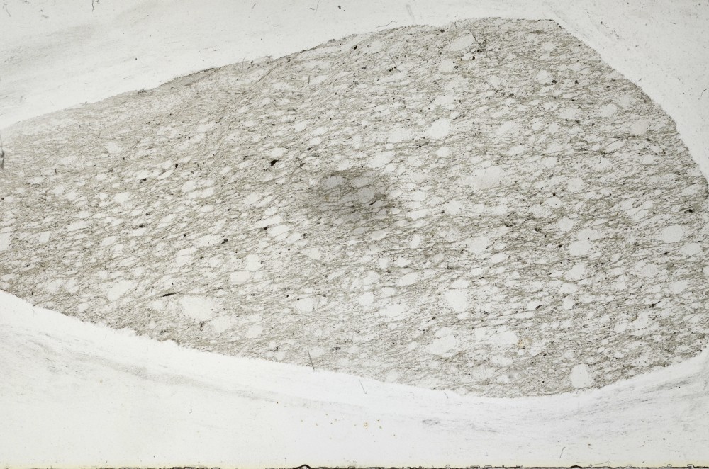 Plane Polarized, S67694