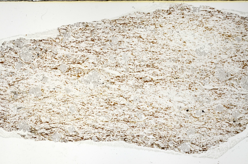 Plane Polarized, S69133