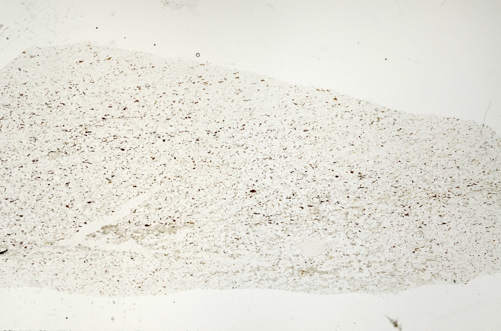 Plane Polarized, S71373