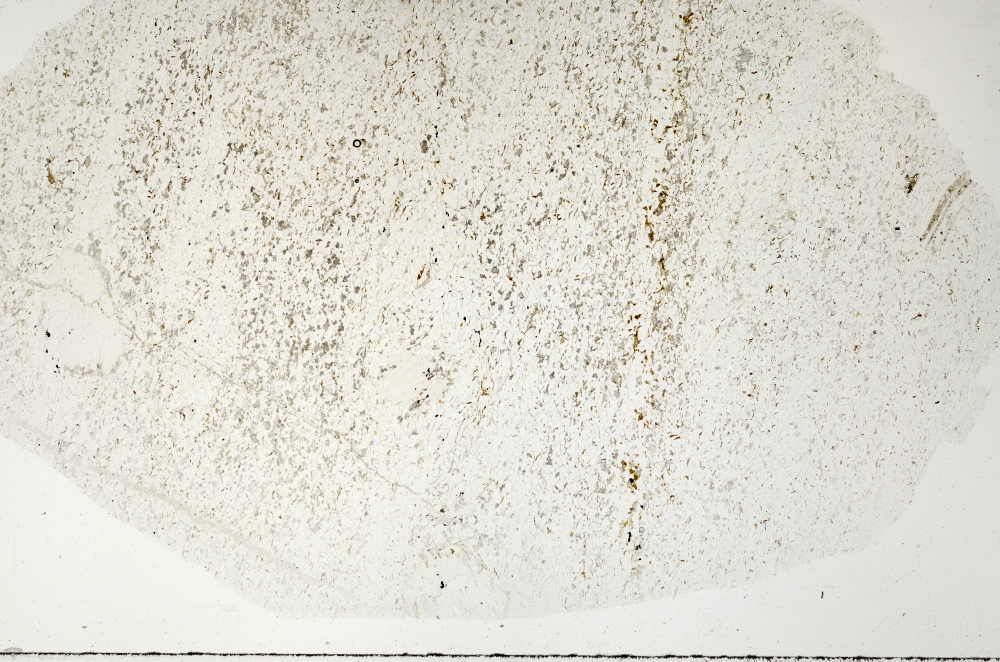 Plane Polarized, S71378