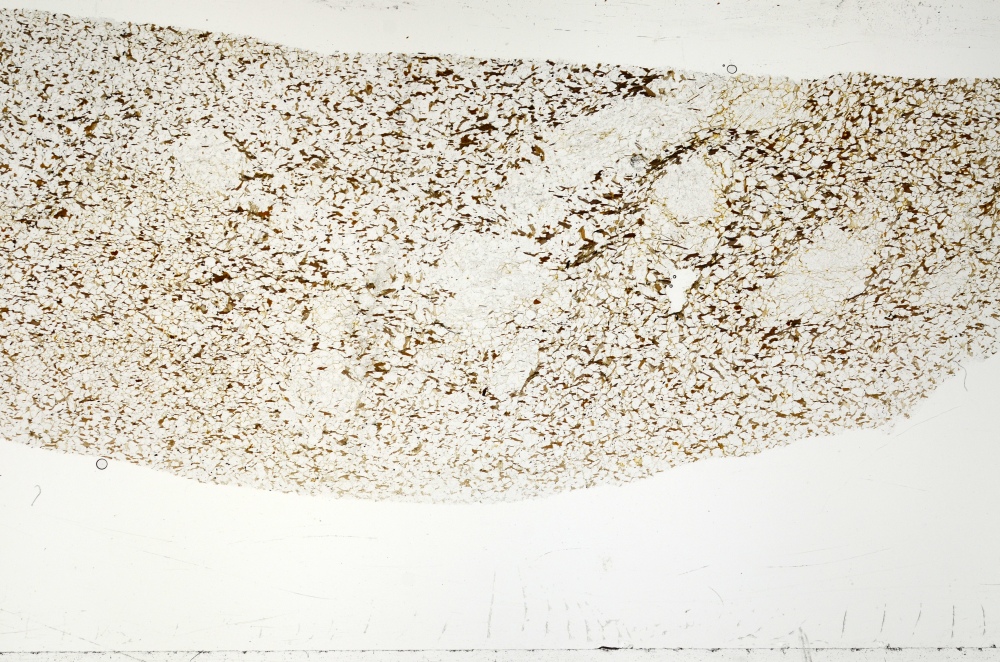 Plane Polarized, S71379